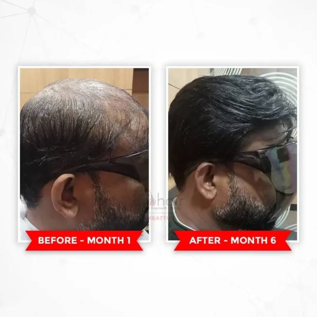 Before and after comparison for hair transformation