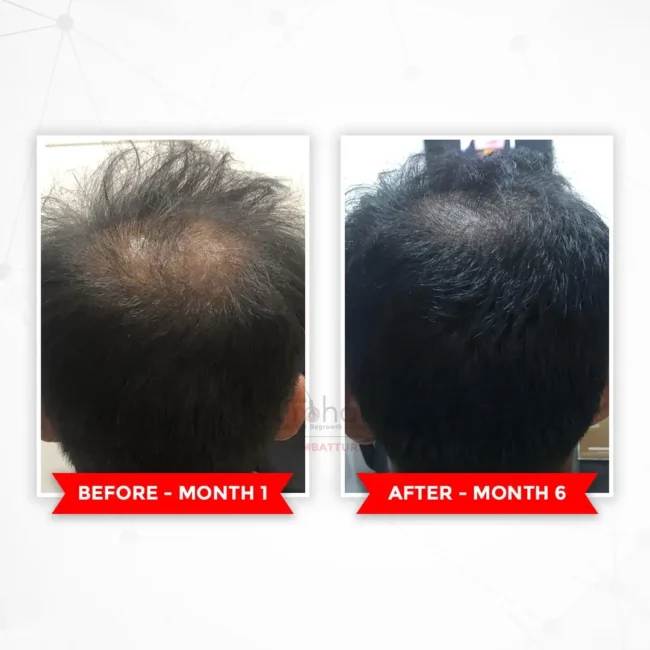 Before and after comparison for hair transformation