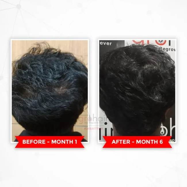 Before and after comparison for hair transformation