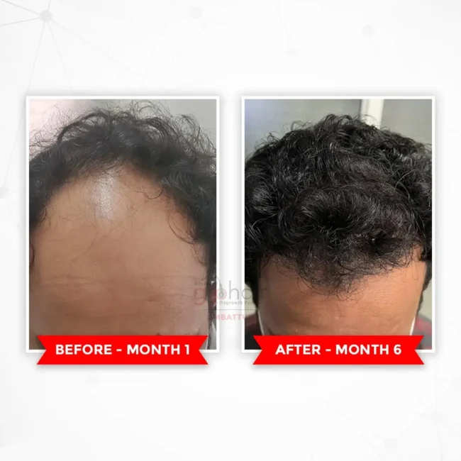 Before and after comparison for hair transformation