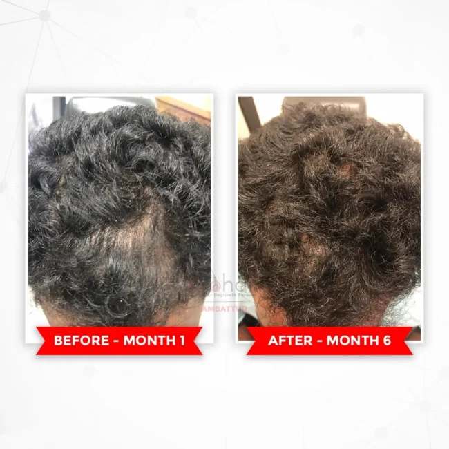 Before and after comparison for hair transformation